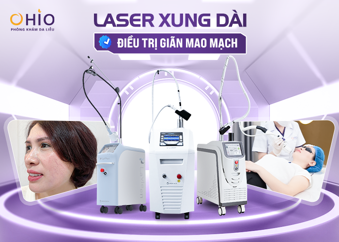 Điều trị giãn mao mạch bằng laser xung dài